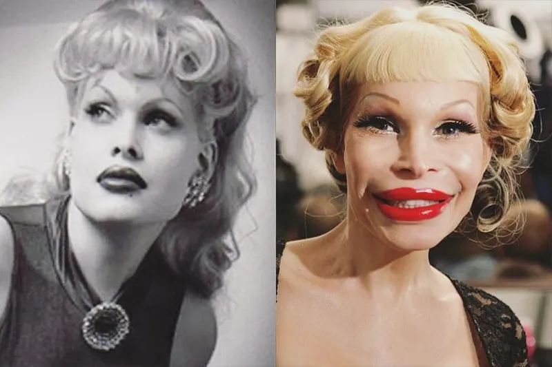 Amanda Lepore