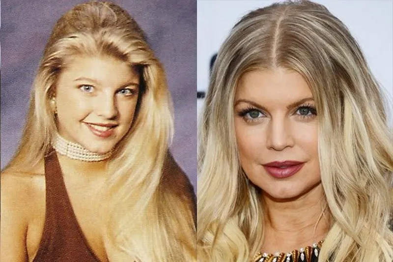 Fergie’s Unrecognizable Transformation