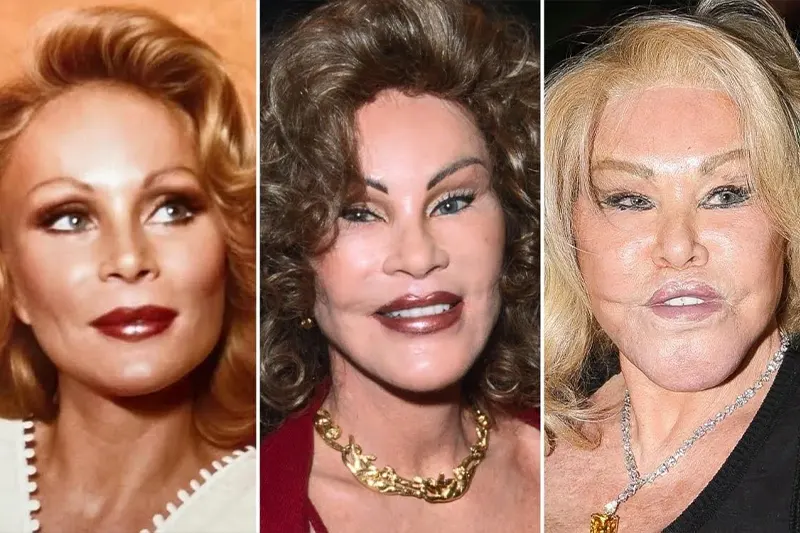 Jocelyn Wildenstein