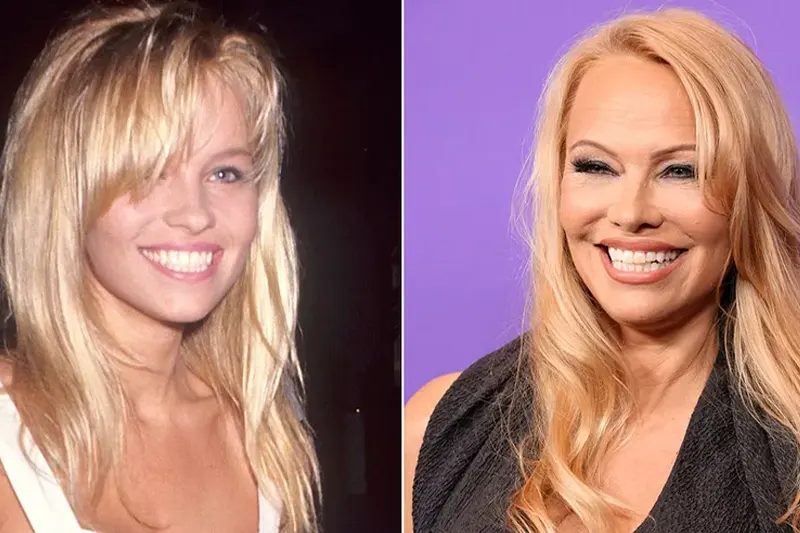 Pamela Anderson