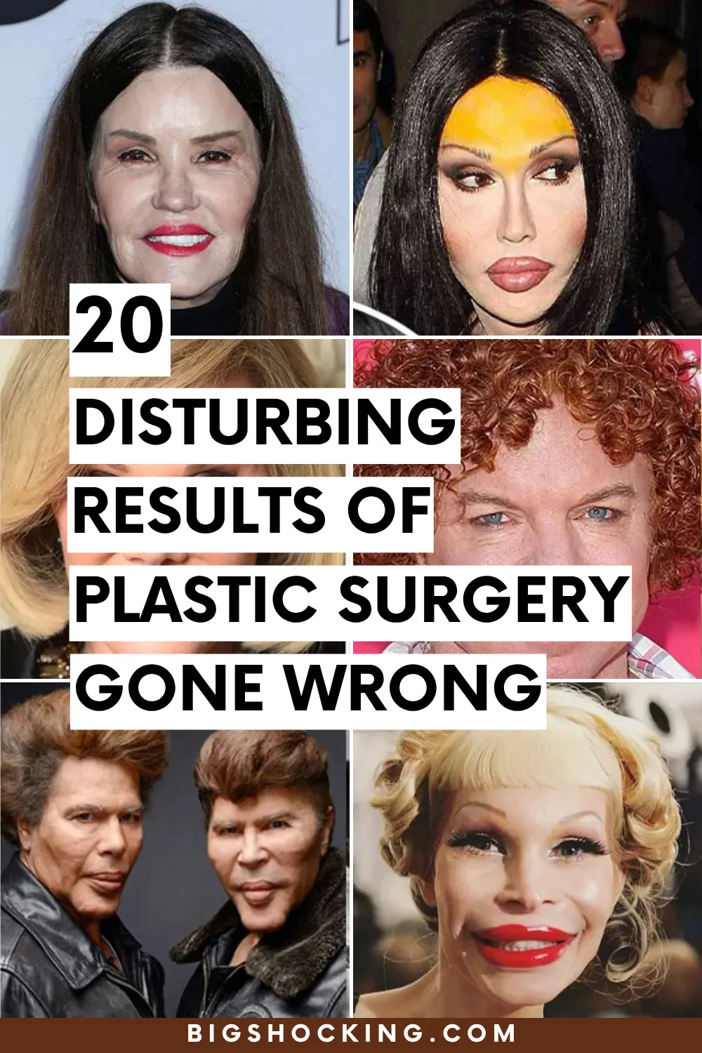20 Disturbing Results of Plastic Surgery Gone Wrong